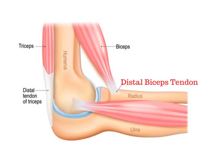 Distal Biceps Tendon Distal Biceps Tendon