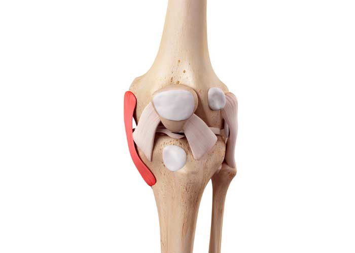 MCL Reconstruction