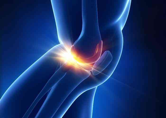 Knee Meniscus Deficiency