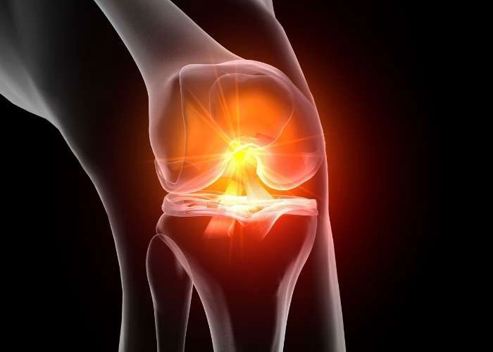 ACL Revision Reconstruction | Atlanta, GA
