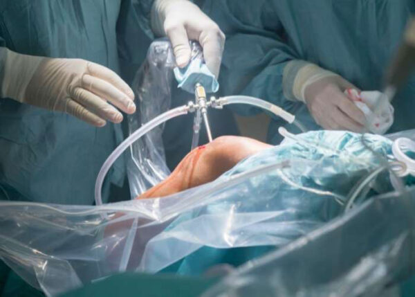 Complex Knee Surgeon | Atlanta, GA