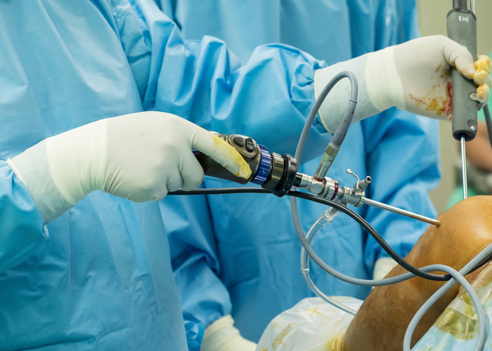 Arthroscopic Stabilization Shoulder Surgery | Atlanta, GA